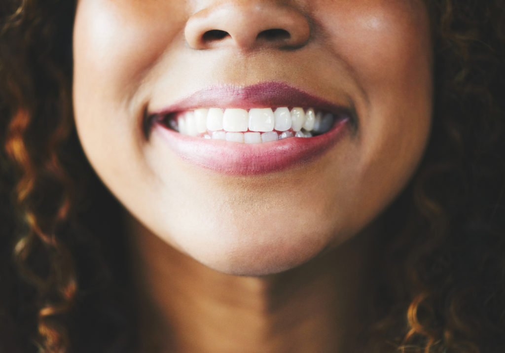 Add Sparkle to your Smile with Porcelain Veneers